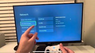 Xbox Series X/S: How to improve internet speeds on Xbox Series X/S (100% WORKS!) (2024)