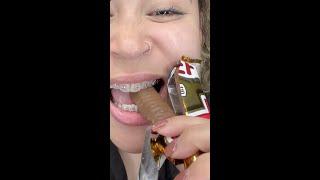 Twix Candy Bar Vs Braces!!   