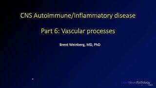 Imaging CNS autoimmune and inflammatory disease - 6 - Vascular