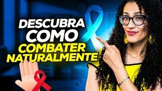 HIV - Como Combater Naturalmente os Sintomas do HIV