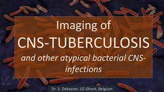 Imaging of CNS-Tuberculosis (and other atypical bacterial infections of the brain).