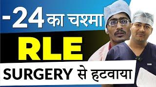 - 24 चश्मे का नंबर RLE सर्जरी से हटवाया | RLE/CLE -  Specs Removal Surgery