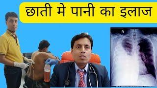 Pleural effusion treatment ll छाती मे पानी का इलाज ll Chest Specialist in patna ll Dr Sanjay kumar