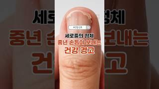 세로줄의 정체, 중년 손톱이 보내는 건강 경고 #중년건강 #손톱세로줄 #건강신호 #갑상선저하증 #영양부족
