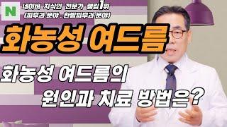 4K)화농성 여드름은 모낭염인 경우가 대부분이며,간단한 방법으로 치료할 수 있습니다