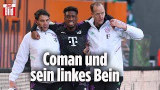 FC Bayern: Droht Kingsley Coman das Karriereende?