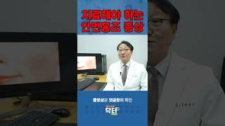 치료해야 하는 안면홍조 증상 / 쿠키건강TV