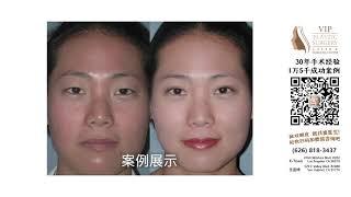 VIP Plastic Surgery | Los Angeles Plastic Surgeon | Dr. Andrew Choi | 洛杉矶名店 | 医疗美容 | 美丽源于自信，更源于专业