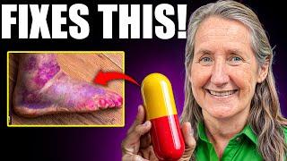 Over 50? This Vitamin FIXES Poor Circulation OVERNIGHT! | Barbara O’Neill