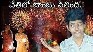 bomb blasted in my hand ? (story time ) - telugu