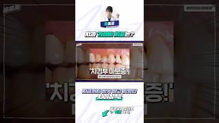 치과에서 숨기는 가성비 시술은? #가성비시술  #치과가성비시술 #가성비치과 #치과가성비 #가성비치료 #치과치료 #치과가성비치료 #가성비