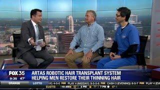 Artas Robotic Transplant in Orlando Florida