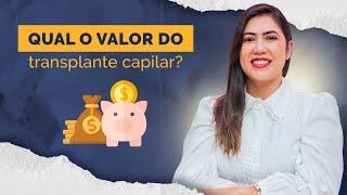 Qual valor do transplante capilar? | icb Transplante Capilar