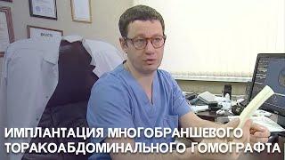 Имплантация многобраншевого торакоабдоминального гомографта