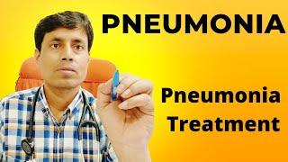 Pneumonia Treatment // #Pneumonia // Dr Sanjay Chest Specialist patna // Chest Specialist in patna