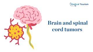 Brain and spinal cord tumors in children - Medical Tourism