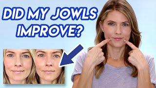 JOWLS UPDATE: How to Treat Jowls and Marionette Lines At Home | Mature Skin