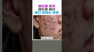여드름 흉터여드름 자국 둘다️없애는 방법 (여드름 닥터) #여드름흉터 #여드름흉터없애는방법 #여드름흉터없애는법 #여드름자국