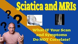 MRI For Sciatica?