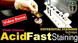 ACID FAST STAINING | Bacterial Staining Technique | Microbiology | Vivek Srinivas | #Mycobacterium