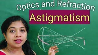 Astigmatism //Causes//Types //With the rule Astigmatism//Simple,compound,Mixed// Symptoms//Treatment