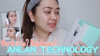 Anlan Technology | Multifunctional Hot&Cold Face Massager | Review| nakakaliit ng mukha!