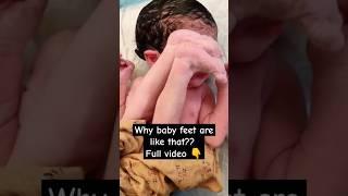 Why are baby feet like that?? #video #music #shorts #baby