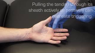 Injection Technique for Trigger Finger