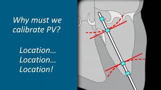 Webinar – Understanding Ventricular Pressure Volume Catheter Calibrations and Experimental Design
