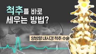 [닥터스] 척추를 바로 세우 양방형 내시경 척추 수술! (박원욱병원/051-1544-7582)