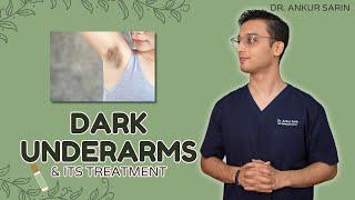 Dark Underarm Treatment | Dark Underarms Whitening | Acanthosis Nigricans | Dr. Ankur Sarin