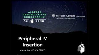 ABSono Ultrasound-Guided Peripheral IV Insertion