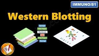 Western Blotting (Immunoblotting) : Principle and Complete Procedure Explained ! (FL-Immuno/81)