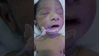 cute  baby  #shakeel #nursing work