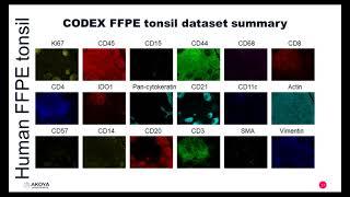 生物标志物PD 1 PD L1治疗靶点的预测指标分析 已完成 丁香学社 丁香通