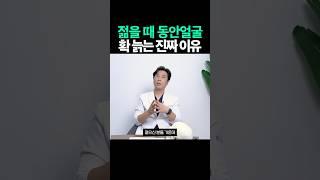 젊을 때 동안얼굴 확 늙는 진짜 이유| 딱 이렇게 하세요 [주름케어 주름관리 입가주름 없애기 동안시술 시술추천 보톡스]