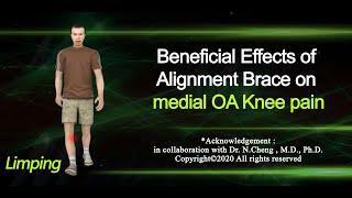 OA Knee Brace : Beneficial Effects of Alignment Brace on medial OA knee pain | K40a |(3d animation)