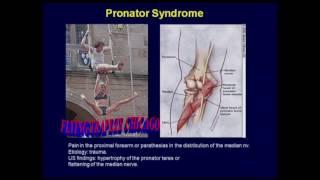 Ultrasound of Peripheral Nerves