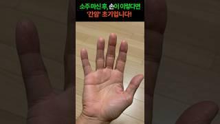 소주 마신 후, 손바닥이 이렇다면 '간암' 초기일 수 있습니다! #건강 #간암 #간암증상 #손바닥