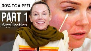 Part 1: How to use TCA peel at home?