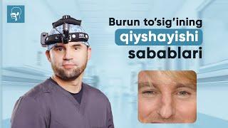 Burun to'sig'ining qiyshayishi ... | Dr Asqar Ashurov
