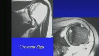 MRI of the Pelvis