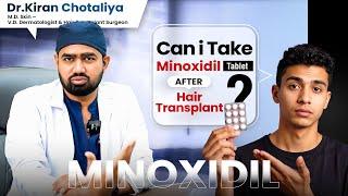 Minoxidil Tablets After Hair Transplant: What You NEED to Know? | Dr. Kiran Chotaliya