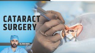 Cataract Surgery: Postoperative Care After Cataract Surgery | Cataract Surgery 2023 | Vision Eye