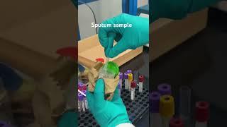 Sputum sample test | Ziehl neelson stain | #shortsvideo #youtubeshorts #vlog #lab