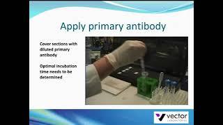 Detection with VECTASTAIN ELITE ABC Kit from Vector Laboratories
