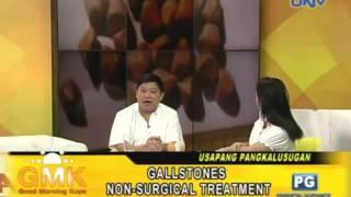 Non-Surgical Treatment to Gallstones [ENG SUB]