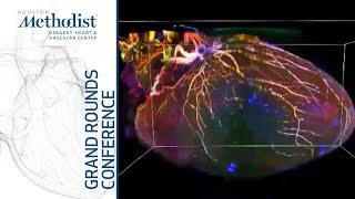 Beyond Catheter Ablation: Neuroscience Inspired Therapies for Arrhythmias (K. Shivkumar MD) 10/14/21