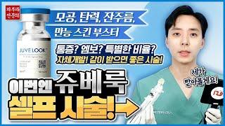 쥬베룩 셀프 시술 후기!  자주 하시는 질문들 모두 말씀드립니다! (feat. 효과, 통증, 엠보, 용량, 후기 등등)