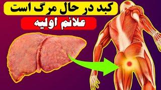 کبد در حال مرگ است ! ۱۲ نشانه عجیب آسیب های کبدی / زودتر آگاه شوید + نحوه درمان